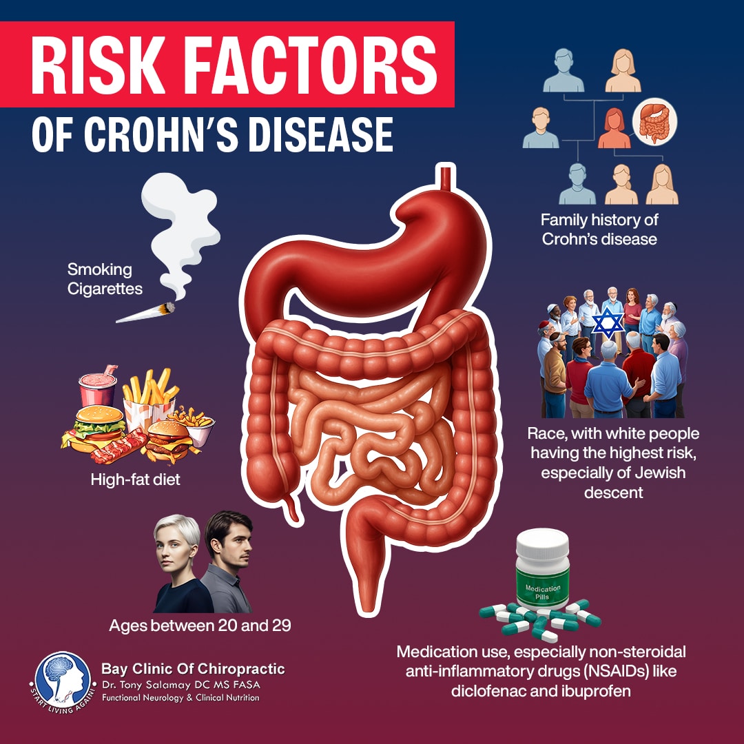 Crohn s Disease Symptoms Causes And Natural Healing Methods