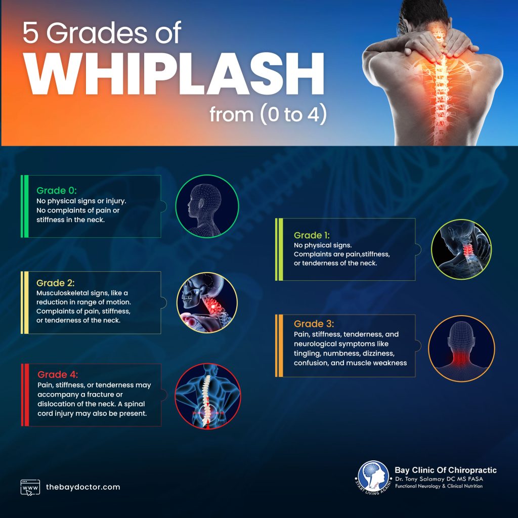 five grades of whiplash