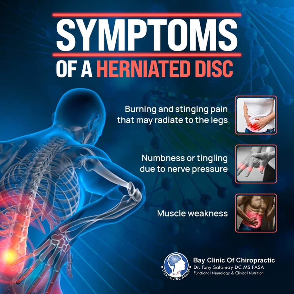 herniated disc symptoms