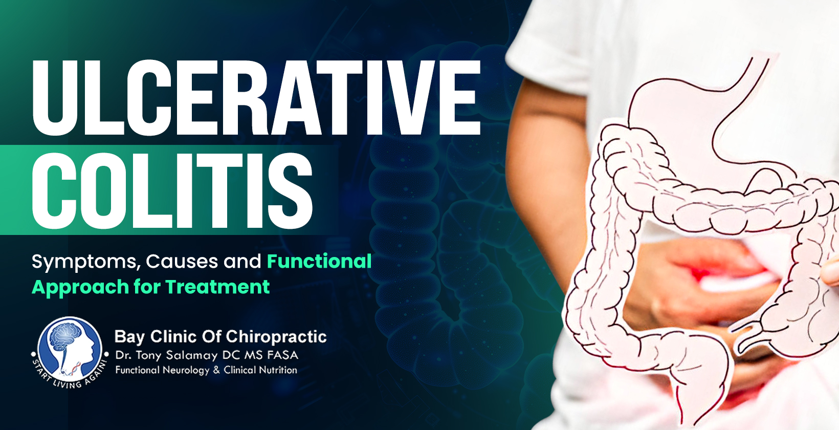 Ulcerative colitis treatments