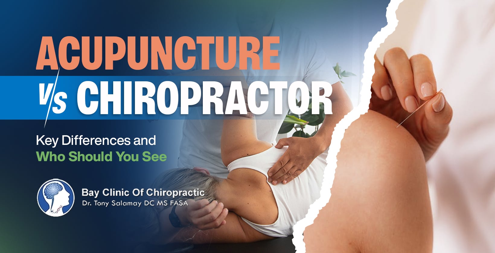 chiropractor vs acupuncture