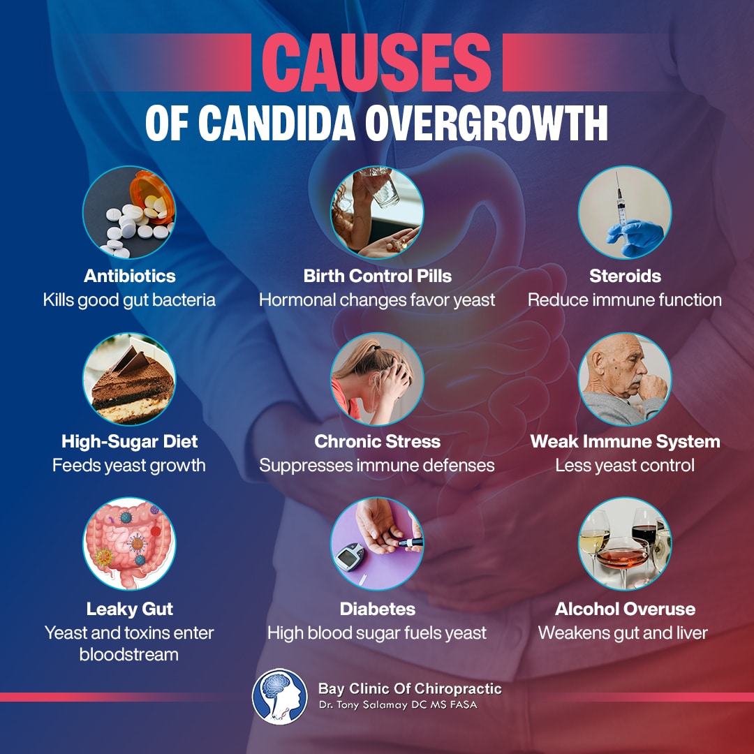Candida Overgrowth: Signs, Causes, and Natural Remedies