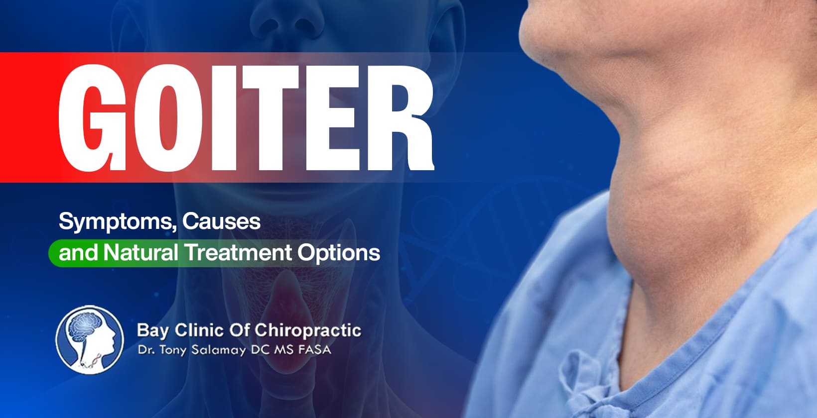 natural treatment of goiter