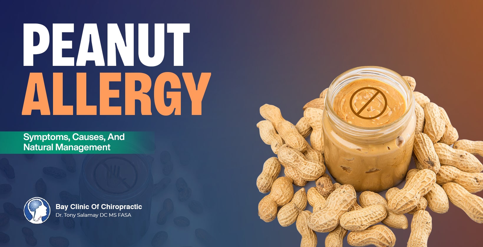 peanut allergy symptoms and treatment
