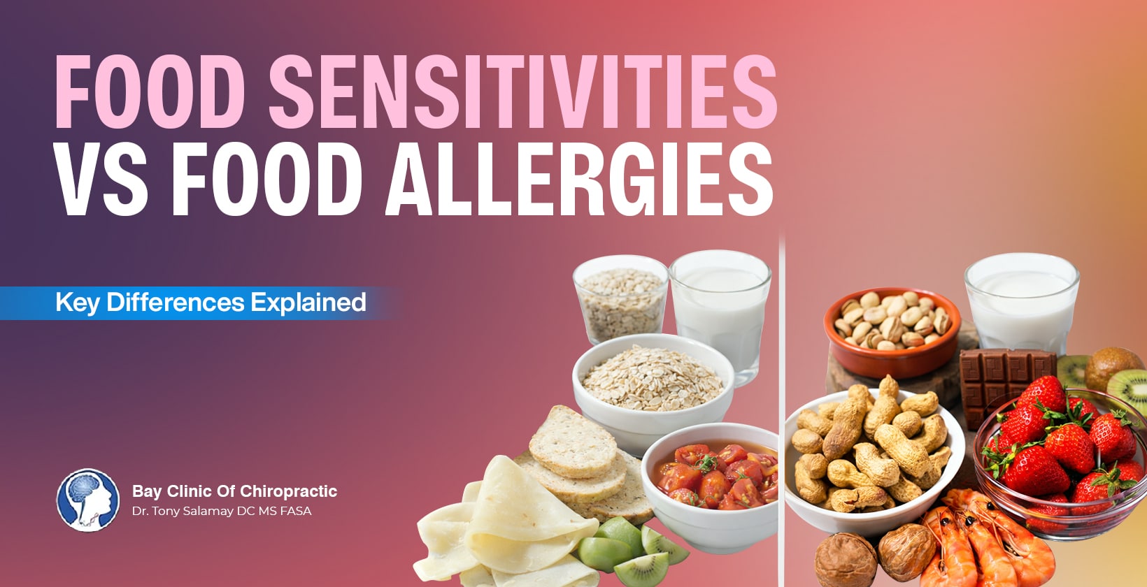 food sensitivities vs food allergies