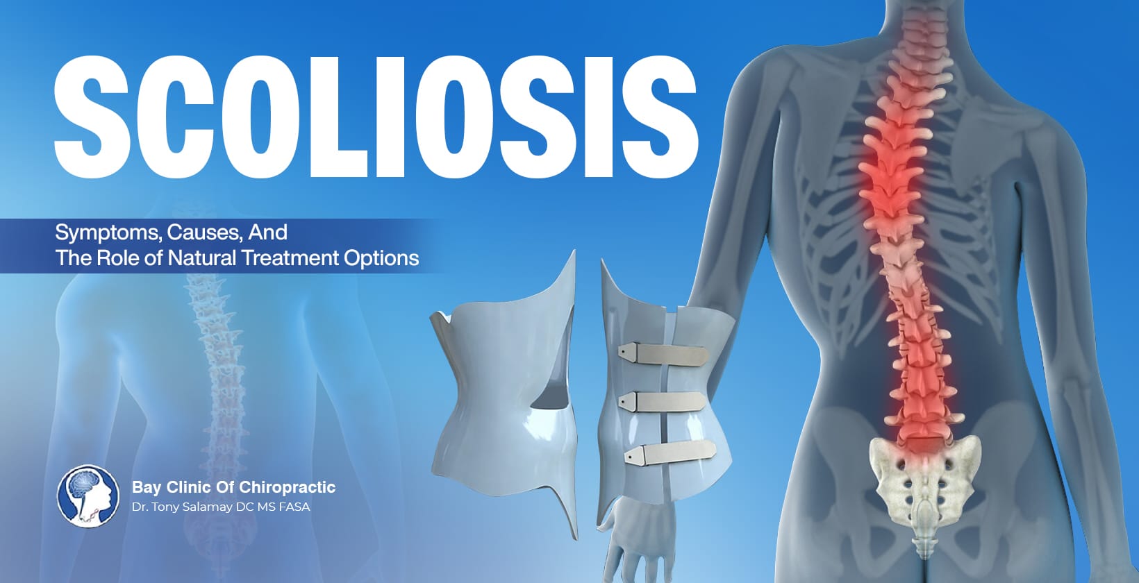 scoliosis natural treatment