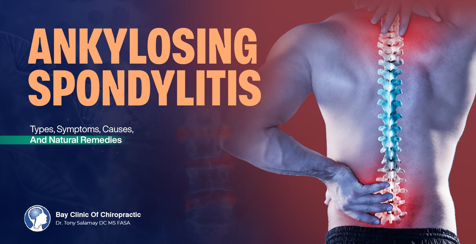 ankylosing spondylitis treatment