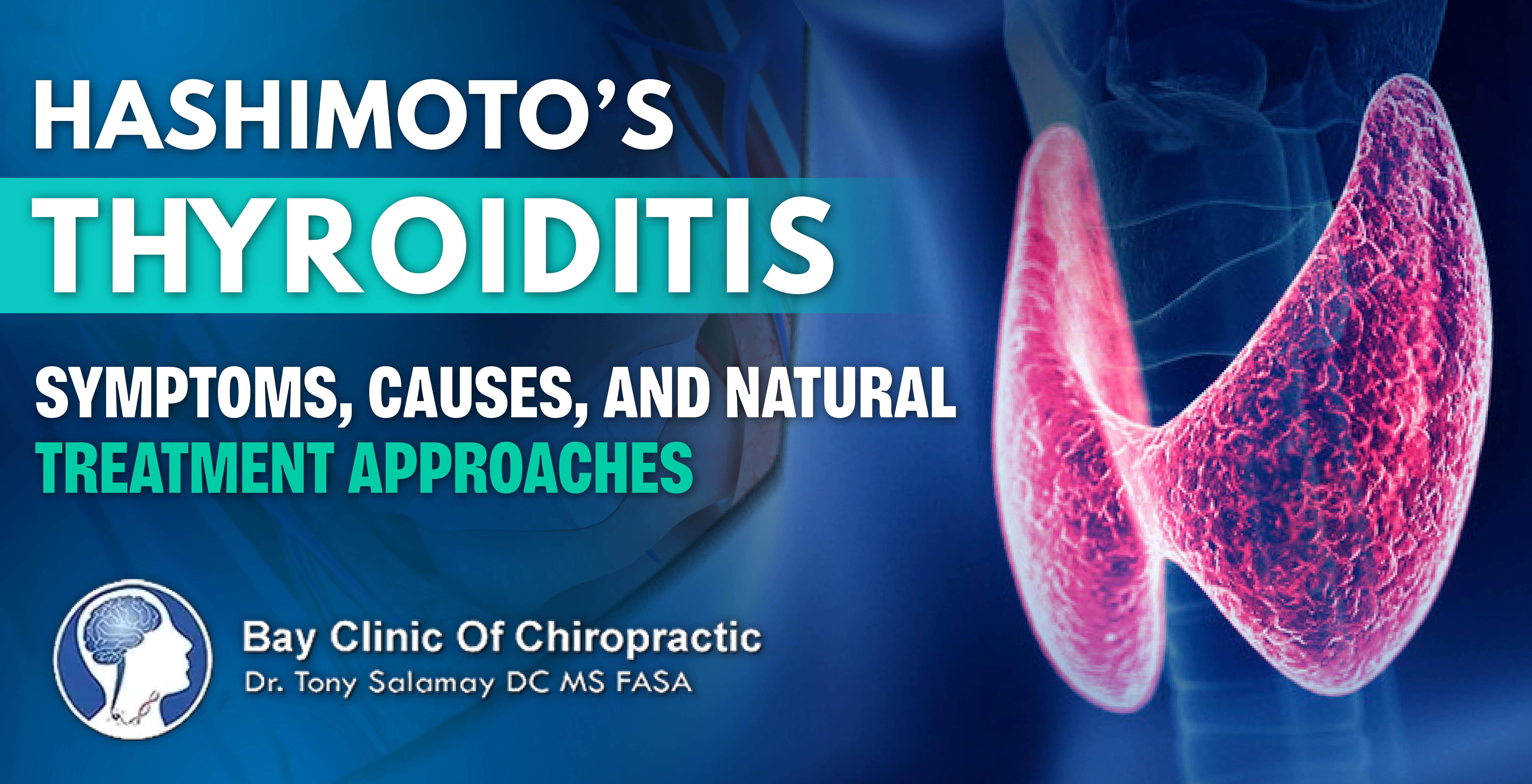 natural treatments of hashimoto's thyroiditis